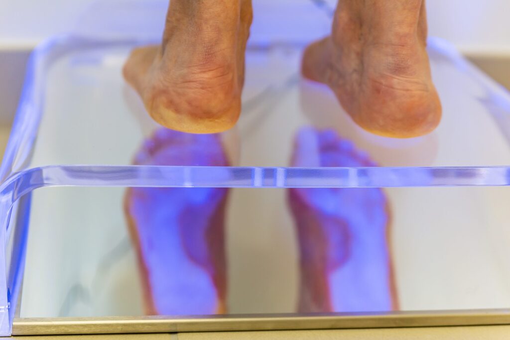la personne est sur un miroir afin de voir la voute plantaire